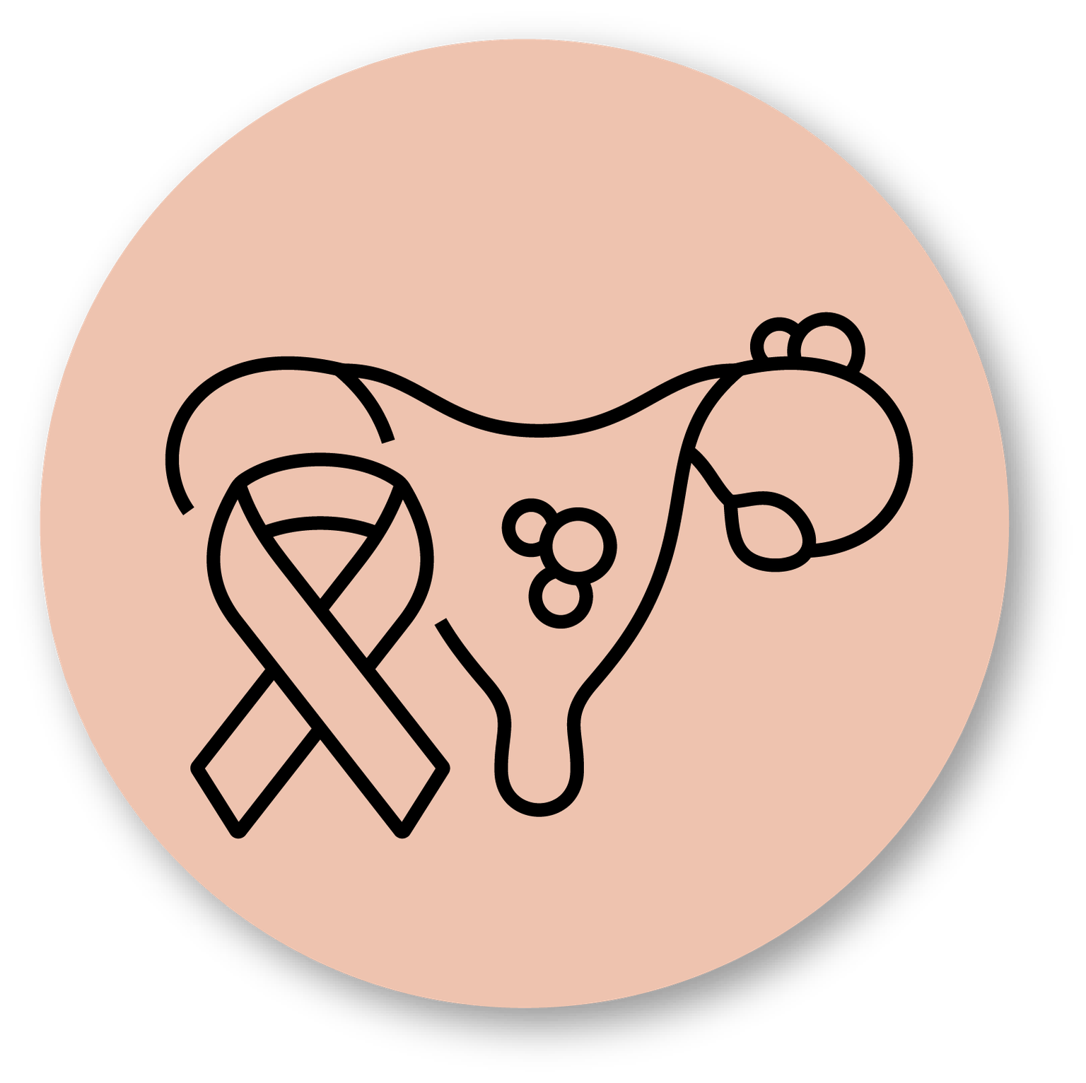 Endometriosis